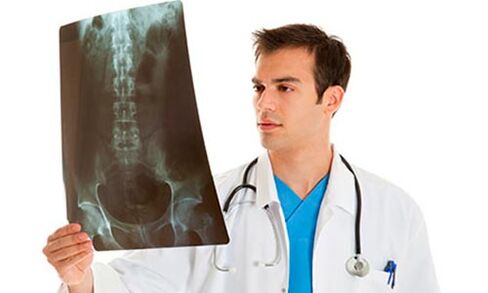 o médico olha um raio-x para diagnosticar a dor lombar