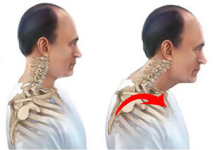 o saudável e o doente a coluna vertebral